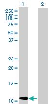 Anti-CCL2 Rabbit Polyclonal Antibody