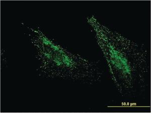 Anti-MBTPS1 Mouse Monoclonal Antibody [clone: 2E6]