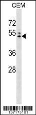 Anti-AP4M1 Rabbit Polyclonal Antibody (FITC (Fluorescein Isothiocyanate))