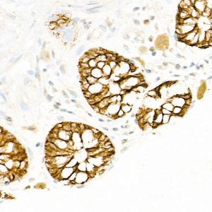 Immunohistochemistry analysis of paraffin-embedded human colon tissue using Anti-FXYD3 Antibody (A307668) at a dilution of 1:100 (40X lens). Perform high pressure antigen retrieval with 10 mM citrate buffer pH 6.0 before commencing with IHC staining protocol