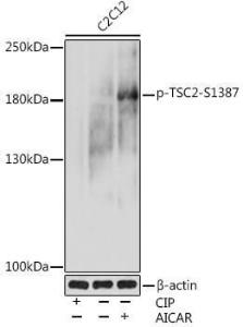 Western blot analysis of extracts of C2C12 cells, using Anti-Tuberin (phospho Ser1387) Antibody (A308810) at 1:1,000 dilution C2C12 cells were treated by CIP(20uL/400ul) at 37°C for 1 hour C2C12 cells were treated by AICAR (0 5 mM) at 37°C for 30 minutes after serum-starvation overnight