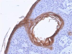 Immunohistochemical analysis of formalin-fixed, paraffin-embedded human skin using Anti-Kallikrein 5 Antibody [KLK5/3841]