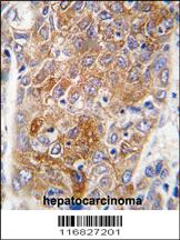 Anti-ALDH1L1 Rabbit Polyclonal Antibody