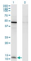 Anti-CCL2 Mouse Monoclonal Antibody [clone: 1F10]