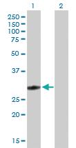 Anti-GSTO1 Mouse Polyclonal Antibody