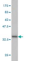 Anti-SEPHS2 Mouse Monoclonal Antibody [clone: 2G9]