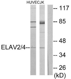 Western blot analysis of lysates from Jurkat and HUVEC cells using Anti-ELAV2 + ELAV4 Antibody. The right hand lane represents a negative control, where the antibody is blocked by the immunising peptide