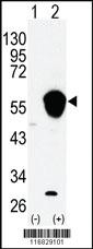 Anti-NPFFR1 Rabbit Polyclonal Antibody