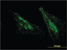 Anti-MBTPS1 Mouse Monoclonal Antibody [clone: 2E6]