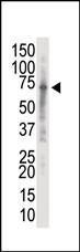 Anti-IRAK2 Rabbit Polyclonal Antibody (HRP (Horseradish Peroxidase))