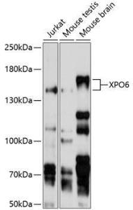 Western blot analysis of extracts of various cell lines, using Anti-XPO6 Antibody (A11307) at 1:1,000 dilution