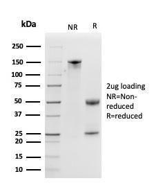 SDS-PAGE analysis of Anti-Kallikrein 5 Antibody [KLK5/3841] under non-reduced and reduced conditions; showing intact IgG and intact heavy and light chains, respectively. SDS-PAGE analysis confirms the integrity and purity of the Antibody