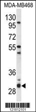 Anti-PSMG2 Rabbit Polyclonal Antibody