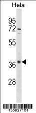 Anti-OR10S1 Rabbit Polyclonal Antibody (FITC (Fluorescein Isothiocyanate))