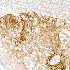 Immunohistochemistry analysis of paraffin-embedded human tonsil using Anti-FXYD3 Antibody (A307668) at a dilution of 1:100 (40X lens). Perform high pressure antigen retrieval with 10 mM citrate buffer pH 6.0 before commencing with IHC staining protocol