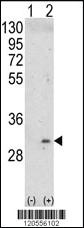 Anti-ITM2A Rabbit Polyclonal Antibody