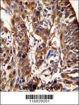 Anti-ALDH3A1 Rabbit Polyclonal Antibody