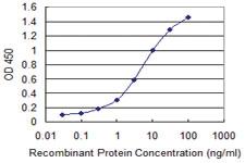 Anti-MBTPS1 Mouse Monoclonal Antibody [clone: 2E6]