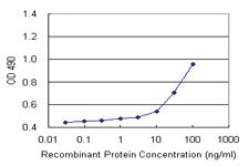 Anti-MCAT Polyclonal Antibody Pair