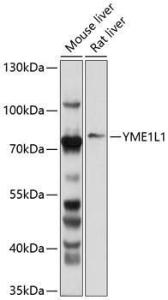 Western blot analysis of extracts of various cell lines, using Anti-YME1L1 Antibody (A11308) at 1:1,000 dilution. The secondary antibody was Goat Anti-Rabbit IgG H&L Antibody (HRP) at 1:10,000 dilution.