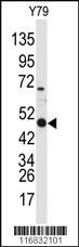 Anti-ALDH3A1 Rabbit Polyclonal Antibody