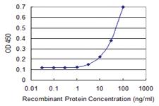 Anti-CCL2 Mouse Monoclonal Antibody [clone: 2E2]