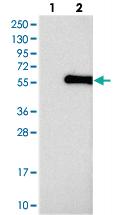 Anti-ABHD8 Rabbit Polyclonal Antibody