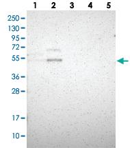 Anti-B4GALT1 Rabbit Polyclonal Antibody