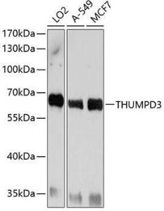 Western blot analysis of extracts of various cell lines, using Anti-THUMPD3 Antibody (A11309) at 1:1,000 dilution. The secondary antibody was Goat Anti-Rabbit IgG H&L Antibody (HRP) at 1:10,000 dilution.