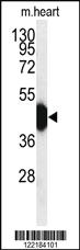 Anti-HFE2 Rabbit Polyclonal Antibody