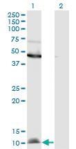 Anti-CCL2 Mouse Monoclonal Antibody [clone: 3H7]