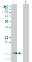 Anti-EDF1 Mouse Polyclonal Antibody