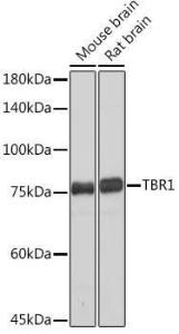 Western blot analysis of extracts of various cell lines, using Anti-TBR1 Antibody [ARC2198] (A307669) at 1:500 dilution