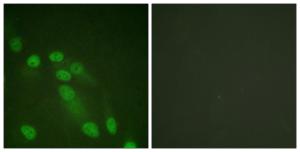 Immunofluorescence analysis of HeLa cells using Anti-NF-kappaB p65 Antibody The right hand panel represents a negative control, where the antibody was pre-incubated with the immunising peptide