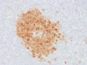 Anti-CD10 Mouse Monoclonal Antibody [clone: MME/1893]