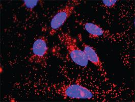 Anti-FAS + CTNNB1 Antibody Pair