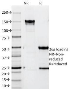 SDS-PAGE analysis of Anti-ZAP70 Antibody [SPM362] under non-reduced and reduced conditions; showing intact IgG and intact heavy and light chains, respectively. SDS-PAGE analysis confirms the integrity and purity of the antibody