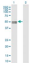 Anti-CYP11A1 Mouse Polyclonal Antibody