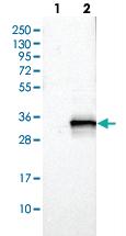 Anti-POLR3GL Rabbit Polyclonal Antibody