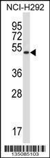 Anti-AGER Rabbit Polyclonal Antibody (PE (Phycoerythrin))