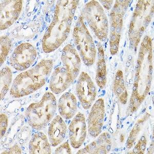 Immunohistochemistry analysis of paraffin-embedded mouse kidney using Anti-THUMPD3 Antibody (A11309) at a dilution of 1:200 (40x lens). Perform high pressure antigen retrieval with 10 mM citrate buffer pH 6.0 before commencing with IHC staining protocol.