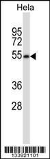 Anti-MAVS Rabbit Polyclonal Antibody (AP (Alkaline Phosphatase))