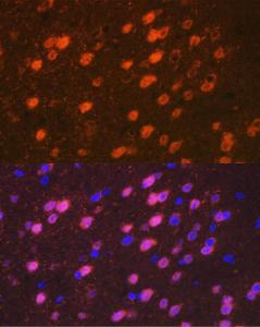 Immunofluorescence analysis of mouse brain cells using Anti-TBR1 Antibody [ARC2198] (A307669) at a dilution of 1:100 (40X lens). DAPI was used to stain the cell nuclei (blue)