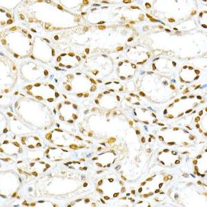 Immunohistochemistry analysis of paraffin-embedded human kidney using Anti-SMAD5 (phospho Ser463 + Ser465) Antibody (A308813) at a dilution of 1:50 (40X lens). Perform high pressure antigen retrieval with 10 mM citrate buffer pH 6.0 before commencing with IHC staining protocol