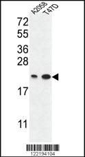 Anti-ABHD14B Rabbit Polyclonal Antibody