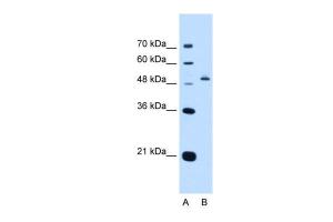 Anti-PAX8 Rabbit Polyclonal Antibody