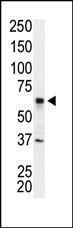 Anti-IRAK2 Rabbit Polyclonal Antibody (HRP (Horseradish Peroxidase))