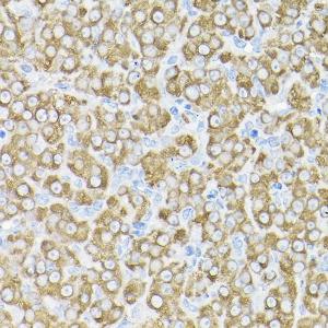 Immunohistochemistry analysis of paraffin-embedded rat ovary using Anti-THUMPD3 Antibody (A11309) at a dilution of 1:200 (40x lens). Perform high pressure antigen retrieval with 10 mM citrate buffer pH 6.0 before commencing with IHC staining protocol.