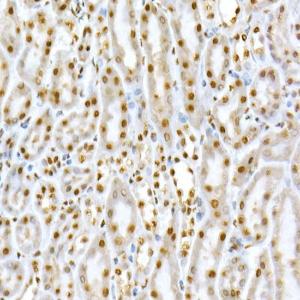 Immunohistochemistry analysis of paraffin-embedded mouse kidney using Anti-SMAD5 (phospho Ser463 + Ser465) Antibody (A308813) at a dilution of 1:50 (40X lens). Perform high pressure antigen retrieval with 10 mM citrate buffer pH 6.0 before commencing with IHC staining protocol