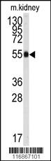 Anti-ALDH9A1 Rabbit Polyclonal Antibody